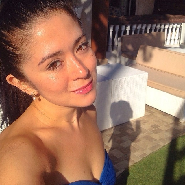 freckles.jpg