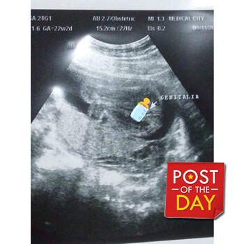 Is it a boy or girl for Melissa Ricks?