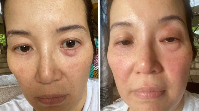 Kris Aquino Warns Followers After Taking In Wrong Medication Getting Her Hand Injured Push Com Ph Your Ultimate Showbiz Hub
